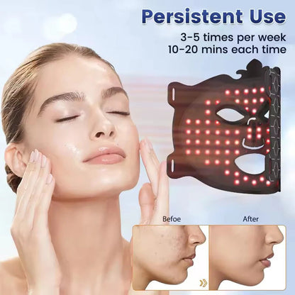 Red Light therapy Mask 460nm 660nm 850nm Sqin Med & Wellness Clinic Niagara